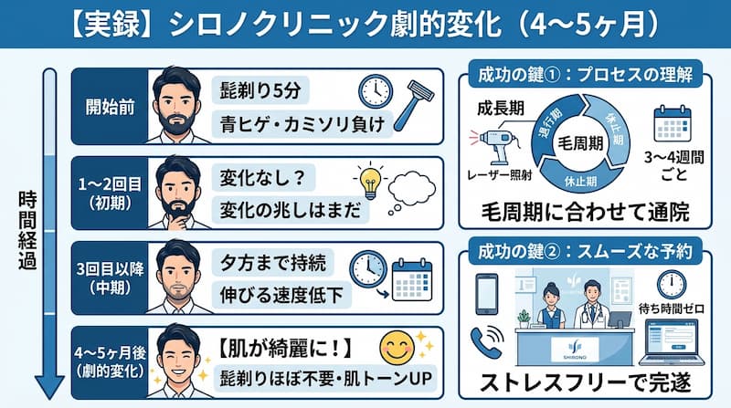 シロノクリニックのメンズヒゲ脱毛における4〜5ヶ月間の劇的変化をまとめた実録チャート。開始前の「青ヒゲ・カミソリ負け」から、3回目以降の「伸びる速度低下」、4〜5ヶ月後の「髭剃りほぼ不要・肌トーンアップ」までの経過を可視化。成功の鍵として、毛周期（成長期・退行期・休止期）に合わせた通院と、待ち時間ゼロのストレスフリーな予約システムの重要性を説く、2026年最新の医療脱毛・美容投資の解説イメージ画像。