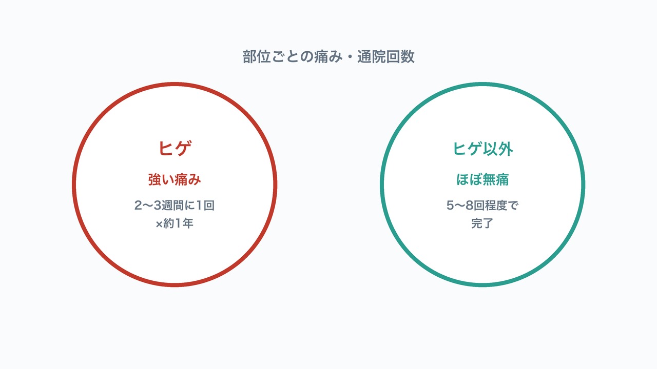 部位ごとの痛み・通院回数の比較図解。ヒゲの強い痛みとヒゲ以外のほぼ無痛を対比した図。