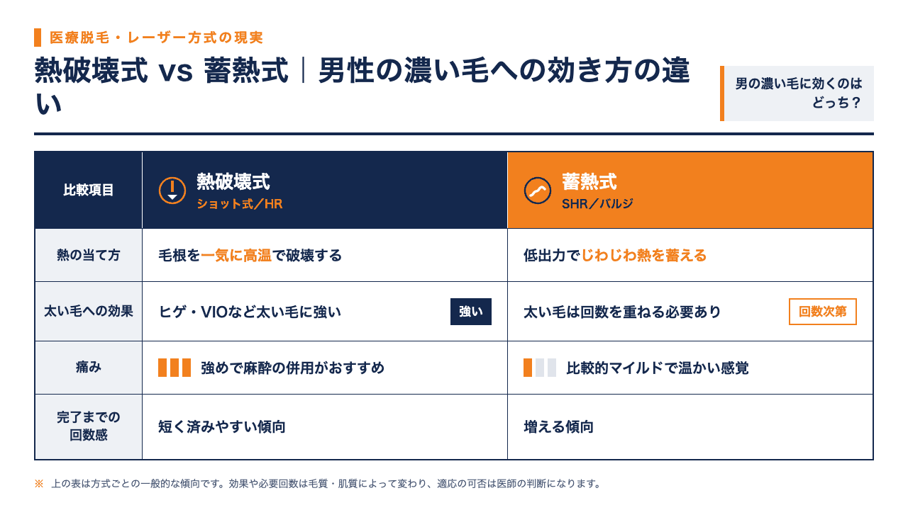 熱破壊式と蓄熱式、2種類のレーザー方式の効き方・痛み・完了までの回数の違いを比較した表のインフォグラフィック