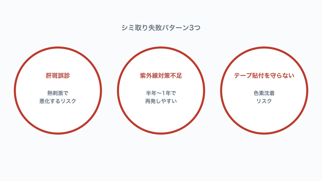 シミ取りレーザーの失敗パターン3つの図解。肝斑誤診・紫外線対策不足・テープ管理の注意点。